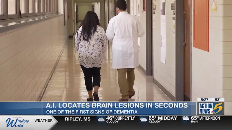 Best Life: AI locates brain lesions in seconds