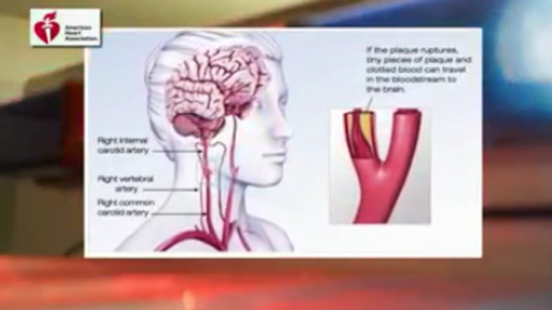The Investigators: Many Mississippians live far from crucial stroke care