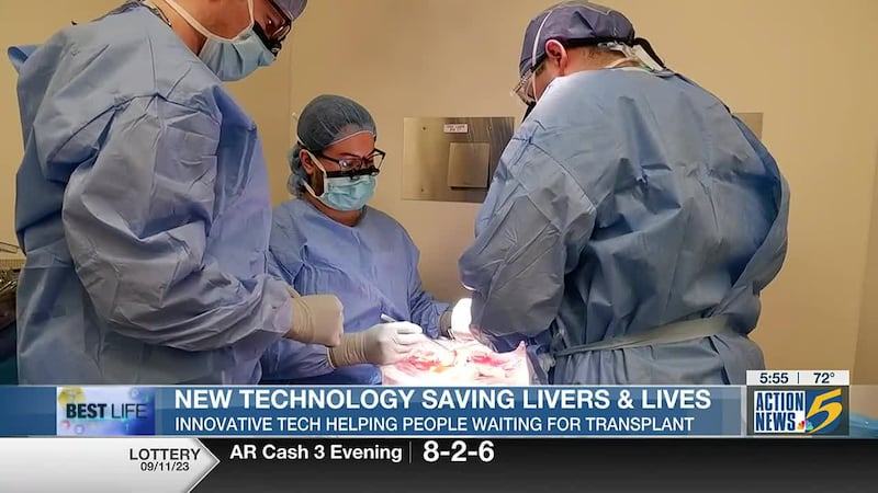 Best Life: New technology saving livers and lives