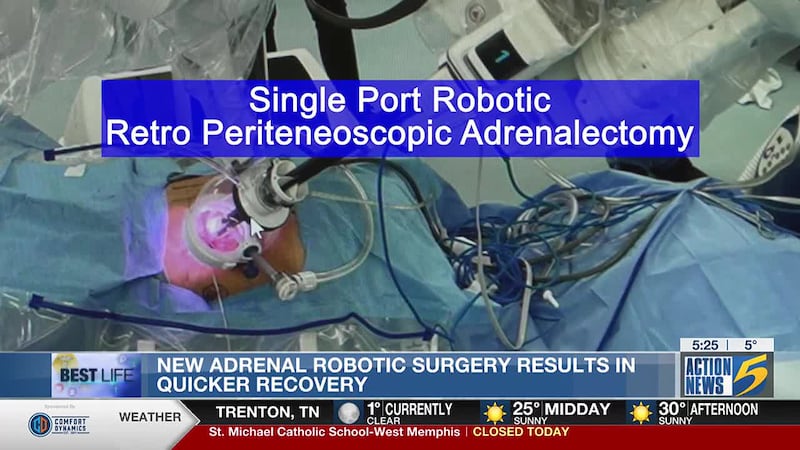 Best Life: New adrenal robotic surgery results in quicker recovery