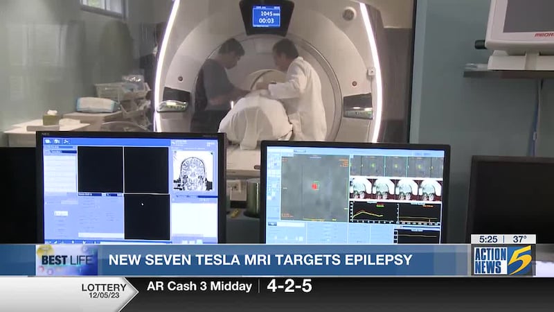 Best Life: New seven tesla MRI targets epilepsy