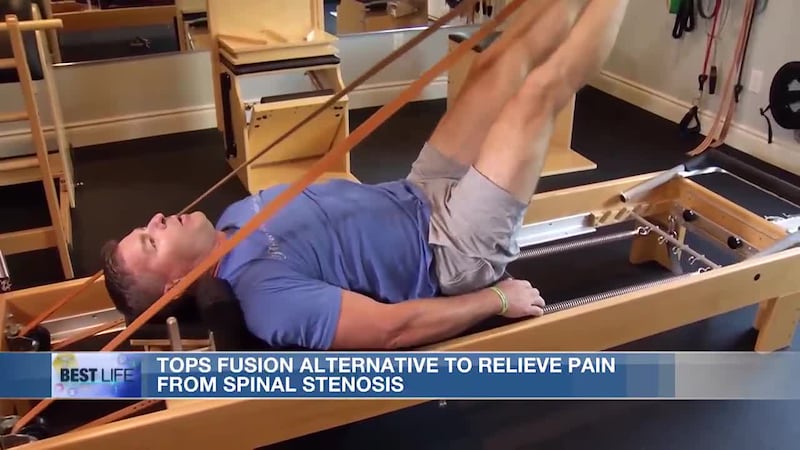 Best Life: Tops fusion alternative to relieve pain from spinal stenosis